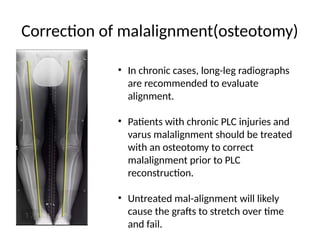 Pf Malalignment Multiligamentous_Knee_Injury CORR.pptx .. | PPTX