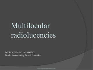 Multilocular
radiolucencies
www.indiandentalacademy.com
INDIAN DENTAL ACADEMY
Leader in continuing Dental Education
 