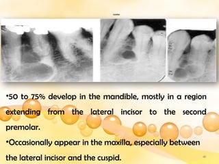 Multilocular Letter multilocular radiolucencies of the jaw... | PPTX
