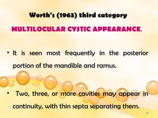 Multilocular Letter multilocular radiolucencies of the jaw... | PPTX