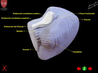 Amígdala Fisura horizontal Flóculo Pedúnculo del Flóculo Nódulo Vermis Pedúnculo cerebeloso medio Pedúnculo cerebeloso superior Francisco Javier Figueroa Guzmán 