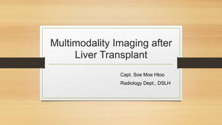 Multimodality Imaging after
Liver Transplant
Capt. Soe Moe Htoo
Radiology Dept., DSLH
 