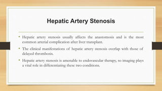 Hepatic Artery Stenosis
• Hepatic artery stenosis usually affects the anastomosis and is the most
common arterial complication after liver transplant.
• The clinical manifestations of hepatic artery stenosis overlap with those of
delayed thrombosis.
• Hepatic artery stenosis is amenable to endovascular therapy, so imaging plays
a vital role in differentiating these two conditions.
 