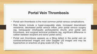 Portal Vein Thrombosis
• Portal vein thrombosis is the most common portal venous complications.
• Risk factors include a hyper-coaguable state, increased downstream
resistance, decreased portal venous inflow, prior portal venous surgery
(eg, transjugular intrahepatic portosystemic shunt), prior portal vein
thrombosis, and surgical technical problems (eg, significant difference in
caliber between recipient and donor portal veins).
• Portal vein thrombosis appears as a filling defect in the portal vein on
contrast-enhanced images and color Doppler US images and may be
hyperechoic or anechoic at gray-scale US (Fig 13).
 