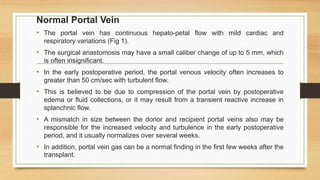 Normal Portal Vein
• The portal vein has continuous hepato-petal flow with mild cardiac and
respiratory variations (Fig 1).
• The surgical anastomosis may have a small caliber change of up to 5 mm, which
is often insignificant.
• In the early postoperative period, the portal venous velocity often increases to
greater than 50 cm/sec with turbulent flow.
• This is believed to be due to compression of the portal vein by postoperative
edema or fluid collections, or it may result from a transient reactive increase in
splanchnic flow.
• A mismatch in size between the donor and recipient portal veins also may be
responsible for the increased velocity and turbulence in the early postoperative
period, and it usually normalizes over several weeks.
• In addition, portal vein gas can be a normal finding in the first few weeks after the
transplant.
 