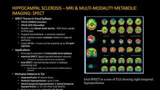 MULTIMODALITY IMAGING IN EhhPILEPSY.nnpptx | PPTX