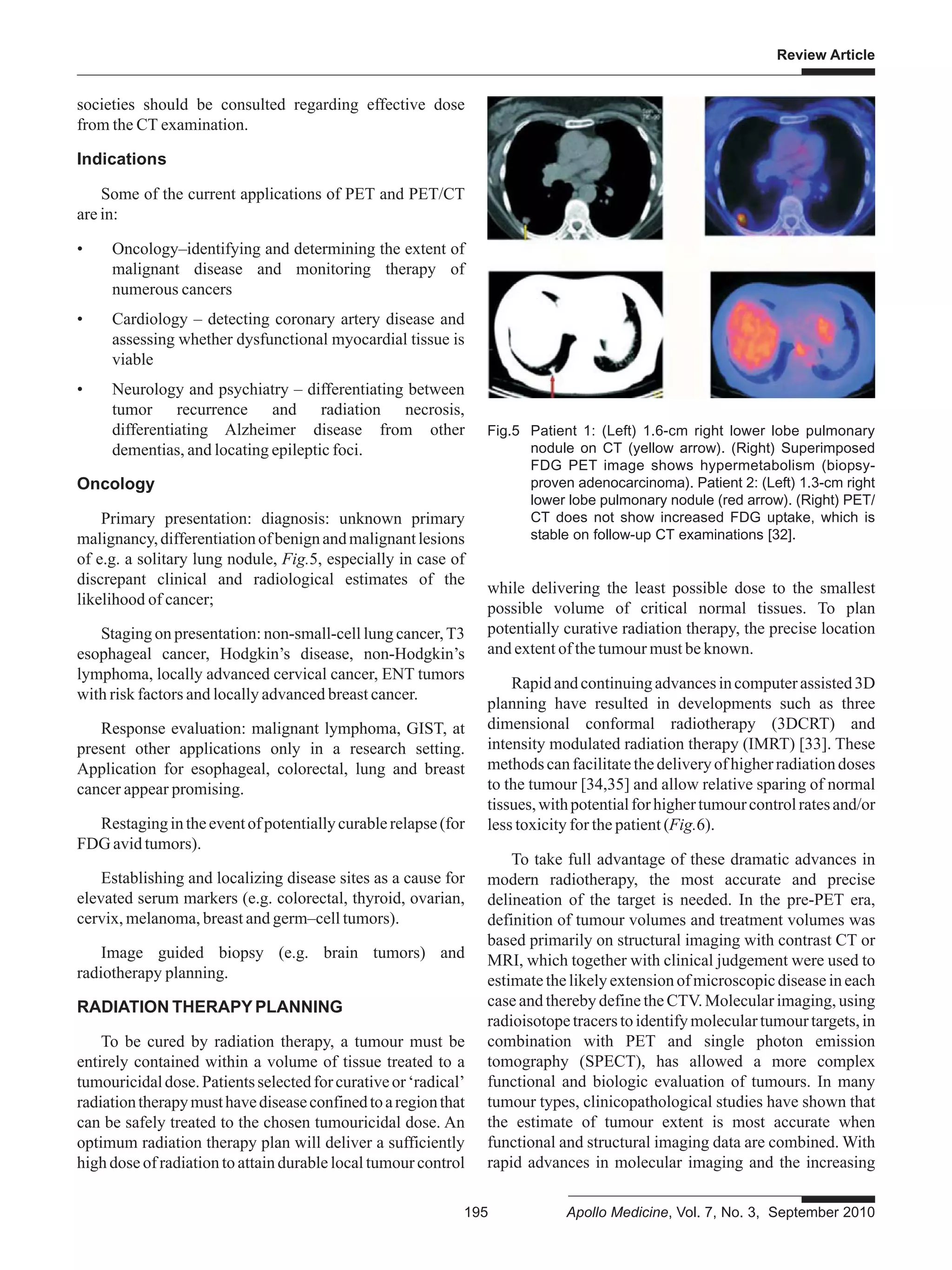 Review Article
195 Apollo Medicine, Vol. 7, No. 3, September 2010
societies should be consulted regarding effective dose
from the CT examination.
Indications
Some of the current applications of PET and PET/CT
are in:
• Oncology–identifying and determining the extent of
malignant disease and monitoring therapy of
numerous cancers
• Cardiology – detecting coronary artery disease and
assessing whether dysfunctional myocardial tissue is
viable
• Neurology and psychiatry – differentiating between
tumor recurrence and radiation necrosis,
differentiating Alzheimer disease from other
dementias, and locating epileptic foci.
Oncology
Primary presentation: diagnosis: unknown primary
malignancy,differentiationofbenignandmalignantlesions
of e.g. a solitary lung nodule, Fig.5, especially in case of
discrepant clinical and radiological estimates of the
likelihood of cancer;
Staging on presentation: non-small-cell lung cancer,T3
esophageal cancer, Hodgkin’s disease, non-Hodgkin’s
lymphoma, locally advanced cervical cancer, ENT tumors
with risk factors and locally advanced breast cancer.
Response evaluation: malignant lymphoma, GIST, at
present other applications only in a research setting.
Application for esophageal, colorectal, lung and breast
cancer appear promising.
Restagingintheeventofpotentiallycurablerelapse(for
FDG avid tumors).
Establishing and localizing disease sites as a cause for
elevated serum markers (e.g. colorectal, thyroid, ovarian,
cervix, melanoma, breast and germ–cell tumors).
Image guided biopsy (e.g. brain tumors) and
radiotherapy planning.
RADIATION THERAPY PLANNING
To be cured by radiation therapy, a tumour must be
entirely contained within a volume of tissue treated to a
tumouricidaldose.Patientsselectedforcurativeor‘radical’
radiationtherapymusthavediseaseconfinedtoaregionthat
can be safely treated to the chosen tumouricidal dose. An
optimum radiation therapy plan will deliver a sufficiently
high dose of radiation to attain durable local tumour control
while delivering the least possible dose to the smallest
possible volume of critical normal tissues. To plan
potentially curative radiation therapy, the precise location
and extent of the tumour must be known.
Rapidandcontinuingadvancesincomputerassisted3D
planning have resulted in developments such as three
dimensional conformal radiotherapy (3DCRT) and
intensity modulated radiation therapy (IMRT) [33]. These
methodscanfacilitatethedeliveryofhigherradiationdoses
to the tumour [34,35] and allow relative sparing of normal
tissues,withpotentialforhighertumourcontrolratesand/or
less toxicity for the patient (Fig.6).
To take full advantage of these dramatic advances in
modern radiotherapy, the most accurate and precise
delineation of the target is needed. In the pre-PET era,
definition of tumour volumes and treatment volumes was
based primarily on structural imaging with contrast CT or
MRI, which together with clinical judgement were used to
estimatethelikelyextensionofmicroscopicdiseaseineach
case and thereby define the CTV. Molecular imaging, using
radioisotopetracerstoidentifymoleculartumourtargets,in
combination with PET and single photon emission
tomography (SPECT), has allowed a more complex
functional and biologic evaluation of tumours. In many
tumour types, clinicopathological studies have shown that
the estimate of tumour extent is most accurate when
functional and structural imaging data are combined. With
rapid advances in molecular imaging and the increasing
Fig.5 Patient 1: (Left) 1.6-cm right lower lobe pulmonary
nodule on CT (yellow arrow). (Right) Superimposed
FDG PET image shows hypermetabolism (biopsy-
proven adenocarcinoma). Patient 2: (Left) 1.3-cm right
lower lobe pulmonary nodule (red arrow). (Right) PET/
CT does not show increased FDG uptake, which is
stable on follow-up CT examinations [32].
 