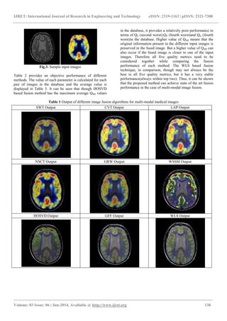 Multi modal medical image fusion using weighted | PDF