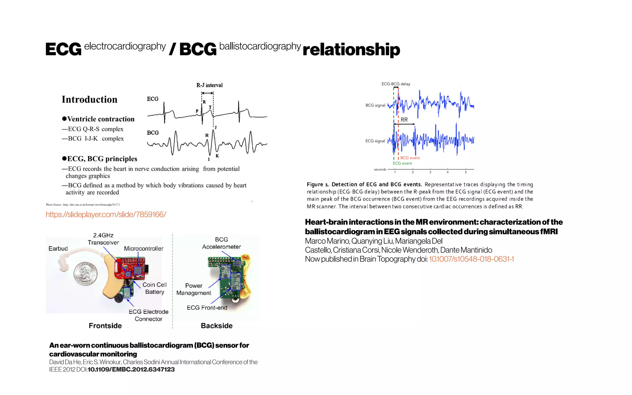 ECGelectrocardiography
/BCGballistocardiography
relationship
Heart-braininteractionsintheMRenvironment:characterizationofthe
ballistocardiograminEEGsignalscollectedduringsimultaneousfMRI
Marco Marino, Quanying Liu, Mariangela Del
Castello, Cristiana Corsi, Nicole Wenderoth, Dante Mantinido
Nowpublishedin BrainTopography doi: 10.1007/s10548-018-0631-1
https://slideplayer.com/slide/7859166/
Anear-worncontinuousballistocardiogram (BCG)sensor for
cardiovascularmonitoring
David DaHe, Eric S. Winokur, CharlesSodiniAnnual International Conference ofthe
IEEE 2012 DOI:10.1109/EMBC.2012.6347123
 