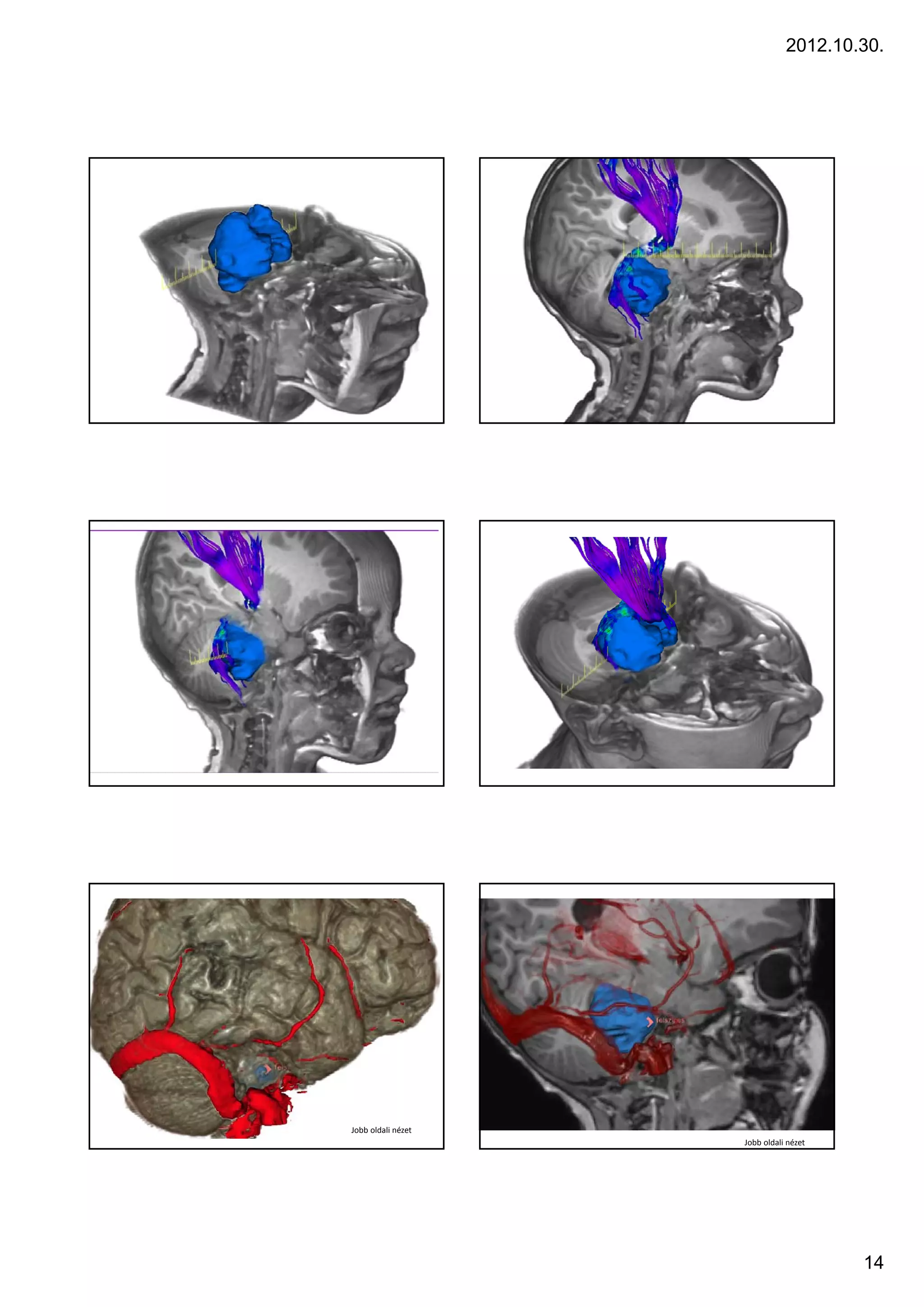 2012.10.30.




Jobb oldali nézet
                    Jobb oldali nézet




                                        14
 
