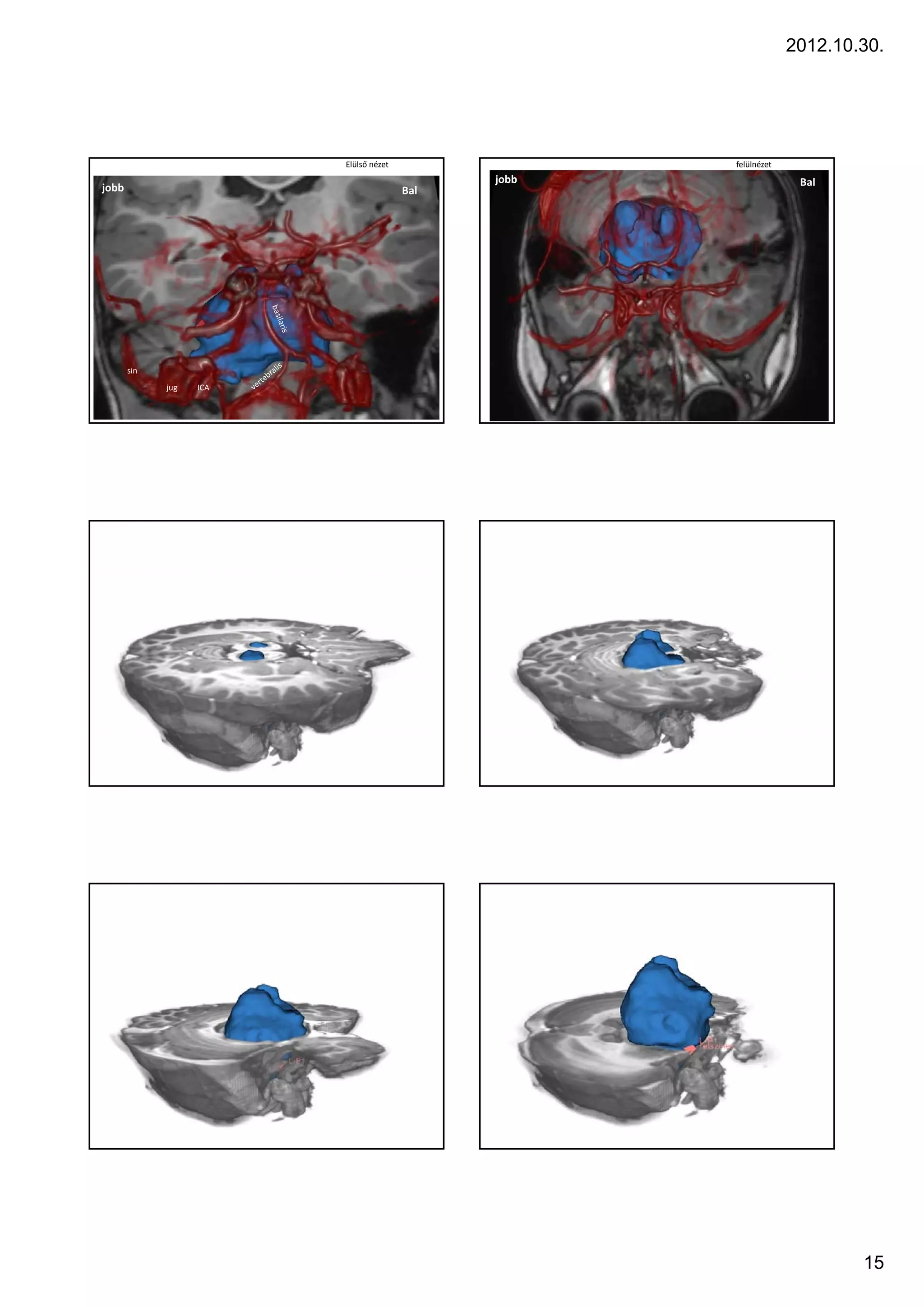 2012.10.30.




                         Elülső nézet                felülnézet
                                              jobb                 Bal
jobb                                    Bal




       sin
             jug   ICA




                                                                          15
 