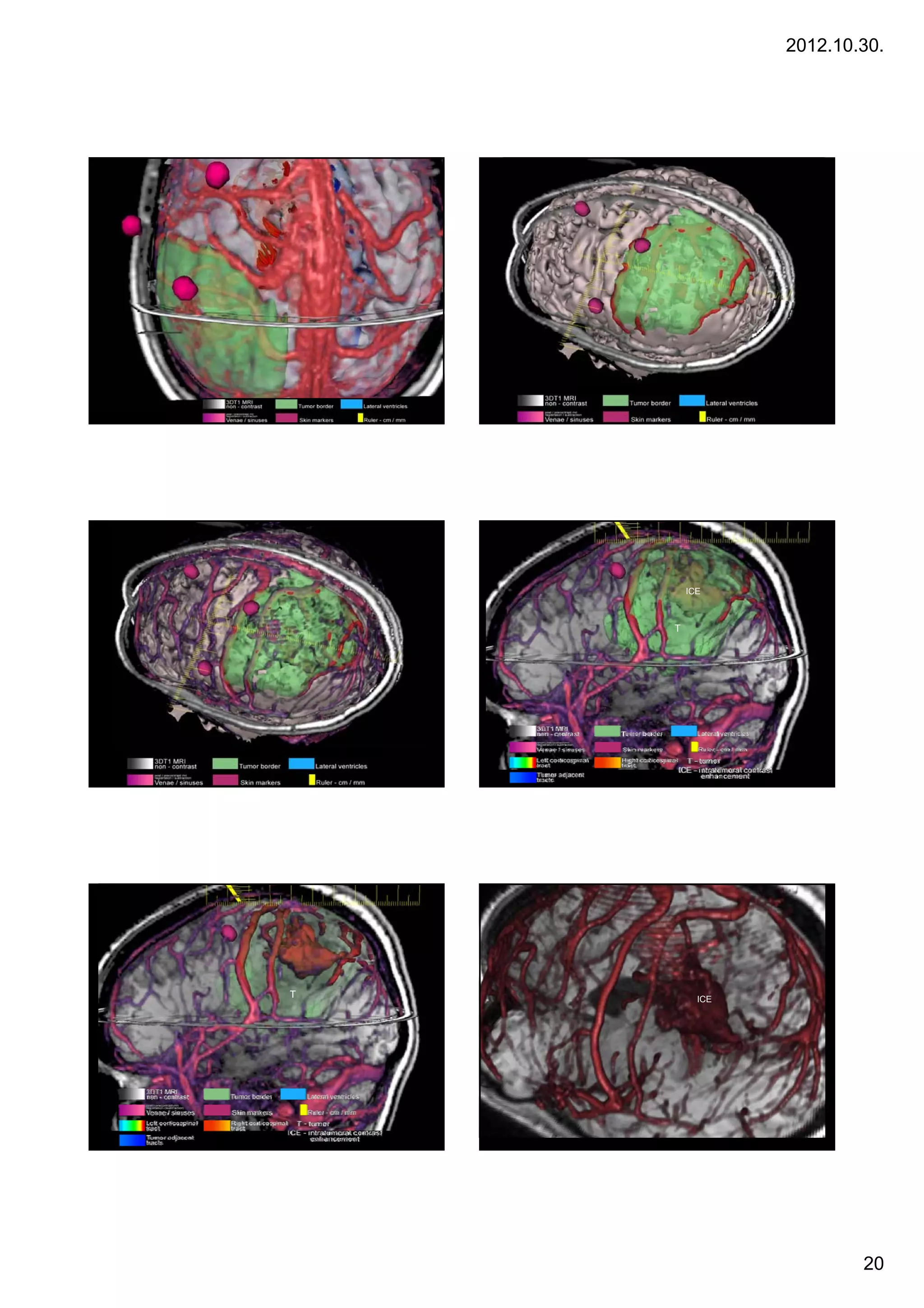 2012.10.30.




              ICE



          T




    ICE




T               ICE




                              20
 