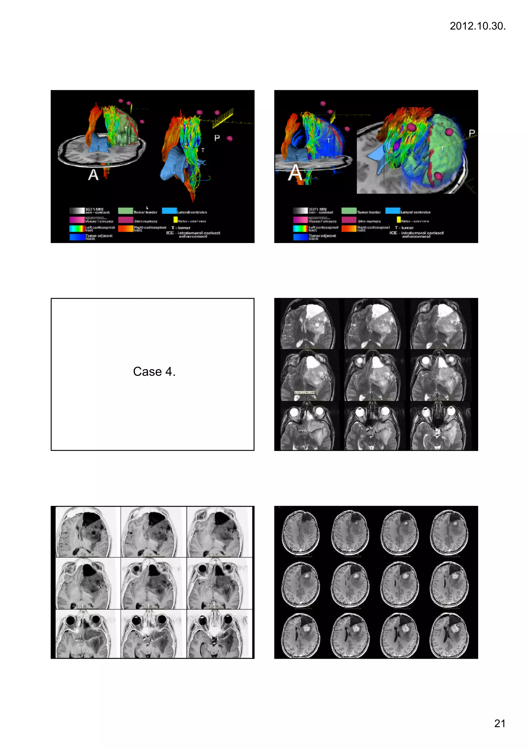 2012.10.30.




T
                  T
              T       T




    Case 4
         4.




                                  21
 