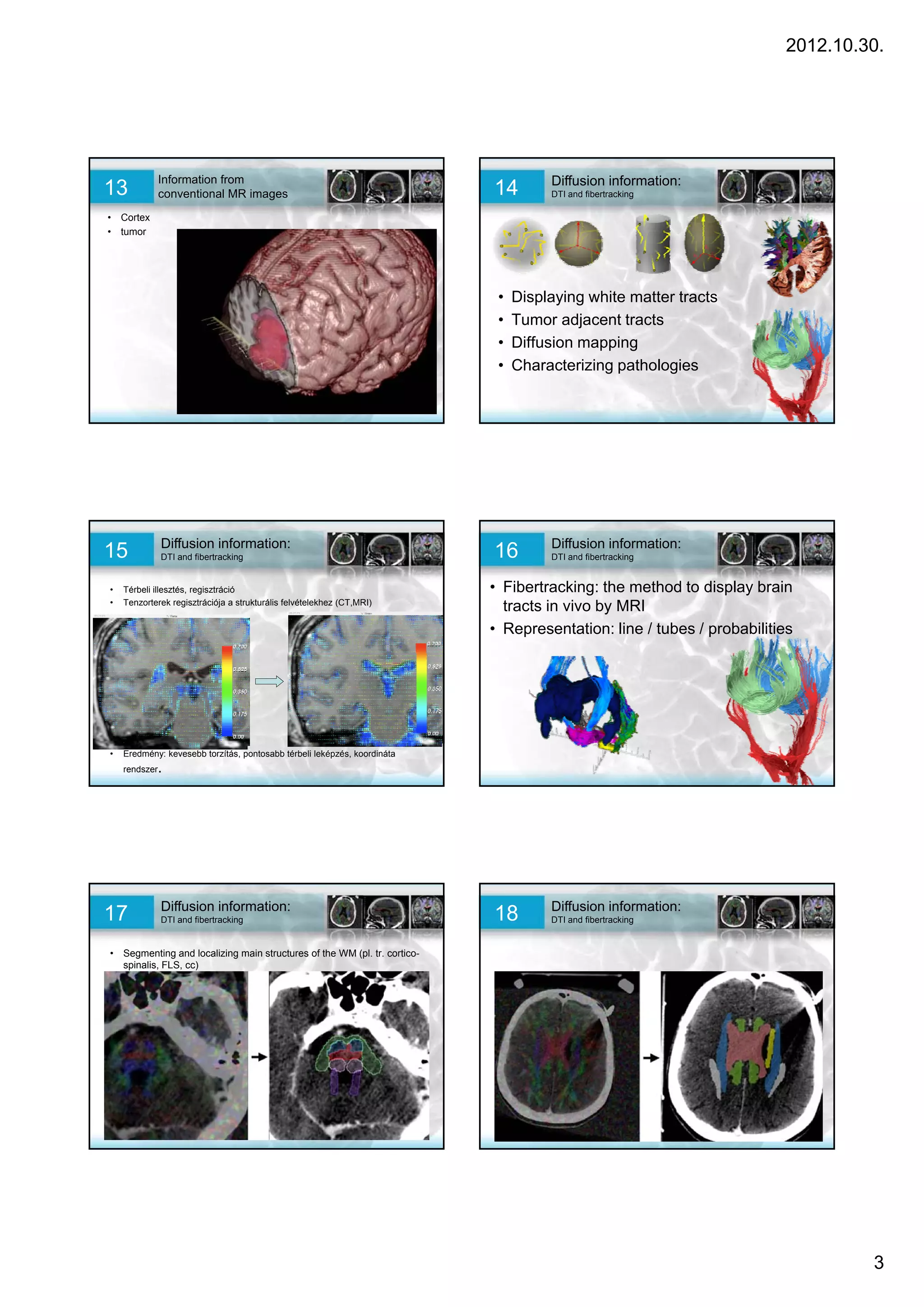 2012.10.30.




            Information from                                                        Diffusion information:
13          conventional MR images                                        14        DTI and fibertracking

• Cortex
• tumor




                                                                           •   Displaying white matter tracts
                                                                           •   Tumor adjacent tracts
                                                                           •   Diffusion mapping
                                                                           •   Characterizing pathologies




             Diffusion information:                                                 Diffusion information:
15           DTI and fibertracking                                        16        DTI and fibertracking


•   Térbeli illesztés, regisztráció                                       • Fibertracking: the method to display brain
•   Tenzorterek regisztrációja a strukturális felvételekhez (CT,MRI)
                                                                            tracts in vivo by MRI
                                                                          • Representation: line / tubes / probabilities




     –

•   Eredmény: kevesebb torzítás, pontosabb térbeli leképzés, koordináta
    rendszer.




             Diffusion information:                                                 Diffusion information:
17           DTI and fibertracking                                        18        DTI and fibertracking


• Segmenting and localizing main structures of the WM (pl. tr. cortico-
  spinalis, FLS, cc)




                                                                                                                               3
 