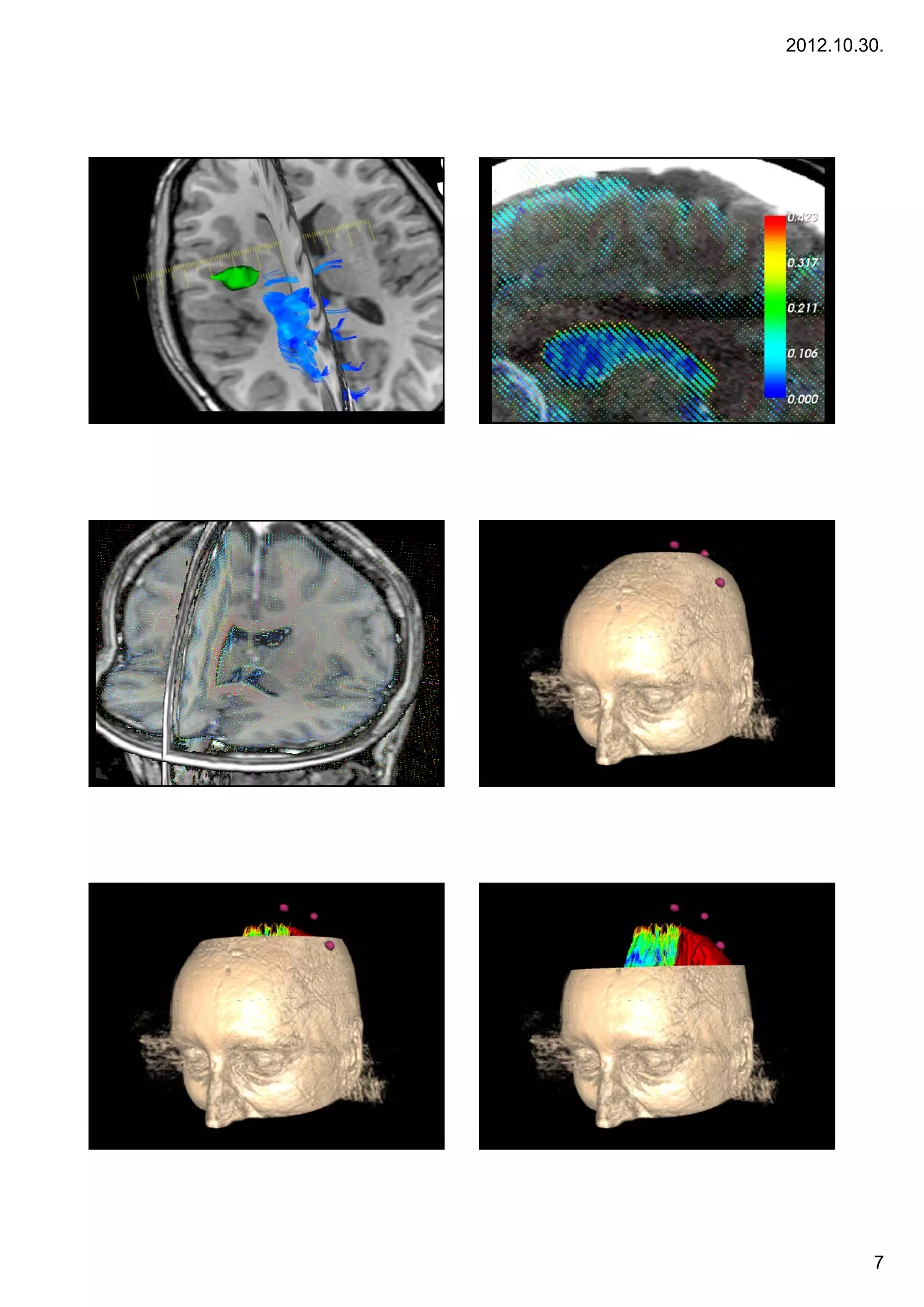 2012.10.30.




                                              Bevezetés
                                         40   A multimodális képalkotás alapjai




     Bevezetés                                Bevezetés
41   A multimodális képalkotás alapjai   42   A multimodális képalkotás alapjai




                                                                                           7
 