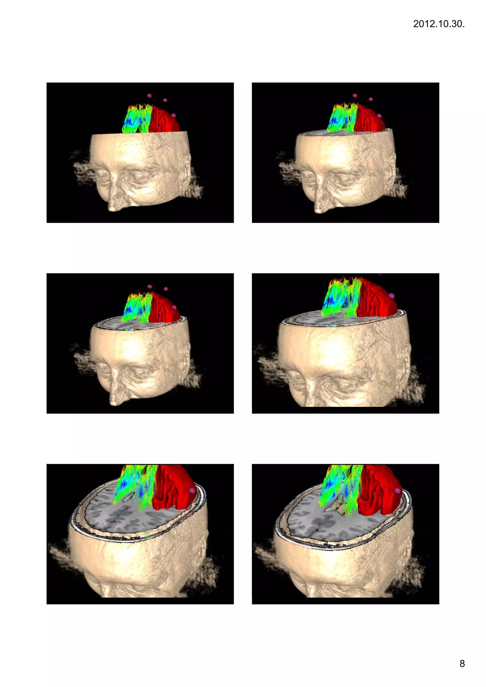 2012.10.30.




     Bevezetés                                Bevezetés
43   A multimodális képalkotás alapjai   44   A multimodális képalkotás alapjai




     Bevezetés                                Bevezetés
45   A multimodális képalkotás alapjai   46   A multimodális képalkotás alapjai




     Bevezetés                                Bevezetés
47   A multimodális képalkotás alapjai   48   A multimodális képalkotás alapjai




                                                                                           8
 