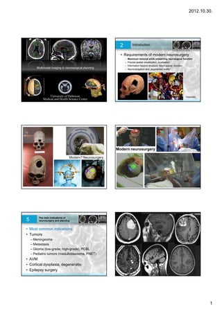 2012.10.30.




                                                          2           Introduction


                                                          • Requirements of modern neurosurgery
                                                              –   Maximum removal while preserving neurological function
                                                              –   Precise spatial visualization, localization
                                                              –   Information beyond structure: blood supply, function
        Multimodal imaging in neurosurgical planning          –   Neuronavigation and „augmented reality”
                                                                                                       reality




                                                                                                                  Trepanatio




                                                        Modern neurosurgery

                                 Modern? Neurosurgery




5        The main indications of
         neurosurgery and planning


• Most common indications
• Tumors
    – Meningeoma
    – Metastasis
    – Glioma (low-grade, high-grade), PCBL
    – Pediatric tumors (medulloblastoma, PNET)
• AVM
• Cortical dysplasia, degeneratio
• Epilepsy surgery




                                                                                                                               1
 