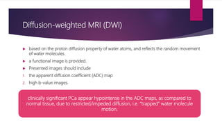Multiparametric (mp) mri of prostate cancer | PPTX