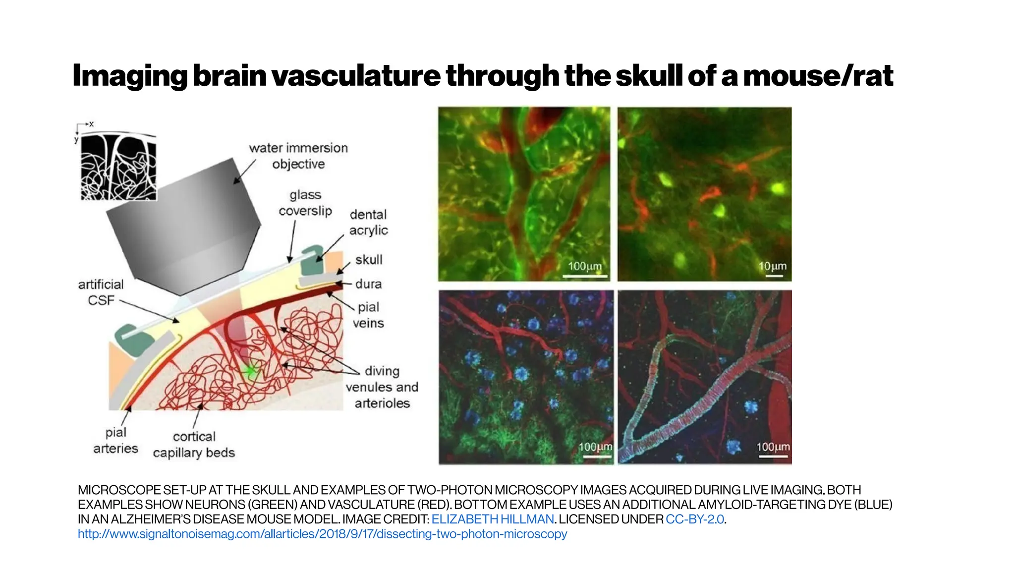 Imaging brainvasculaturethroughtheskullof a mouse/rat
MICROSCOPE SET-UP AT THE SKULL AND EXAMPLES OF TWO-PHOTON MICROSCOPYIMAGES ACQUIRED DURINGLIVE IMAGING.BOTH
EXAMPLES SHOWNEURONS (GREEN)ANDVASCULATURE (RED).BOTTOMEXAMPLE USES AN ADDITIONAL AMYLOID-TARGETING DYE (BLUE)
IN AN ALZHEIMER’S DISEASE MOUSE MODEL. IMAGE CREDIT: ELIZABETH HILLMAN. LICENSED UNDER CC-BY-2.0.
http://www.signaltonoisemag.com/allarticles/2018/9/17/dissecting-two-photon-microscopy
 