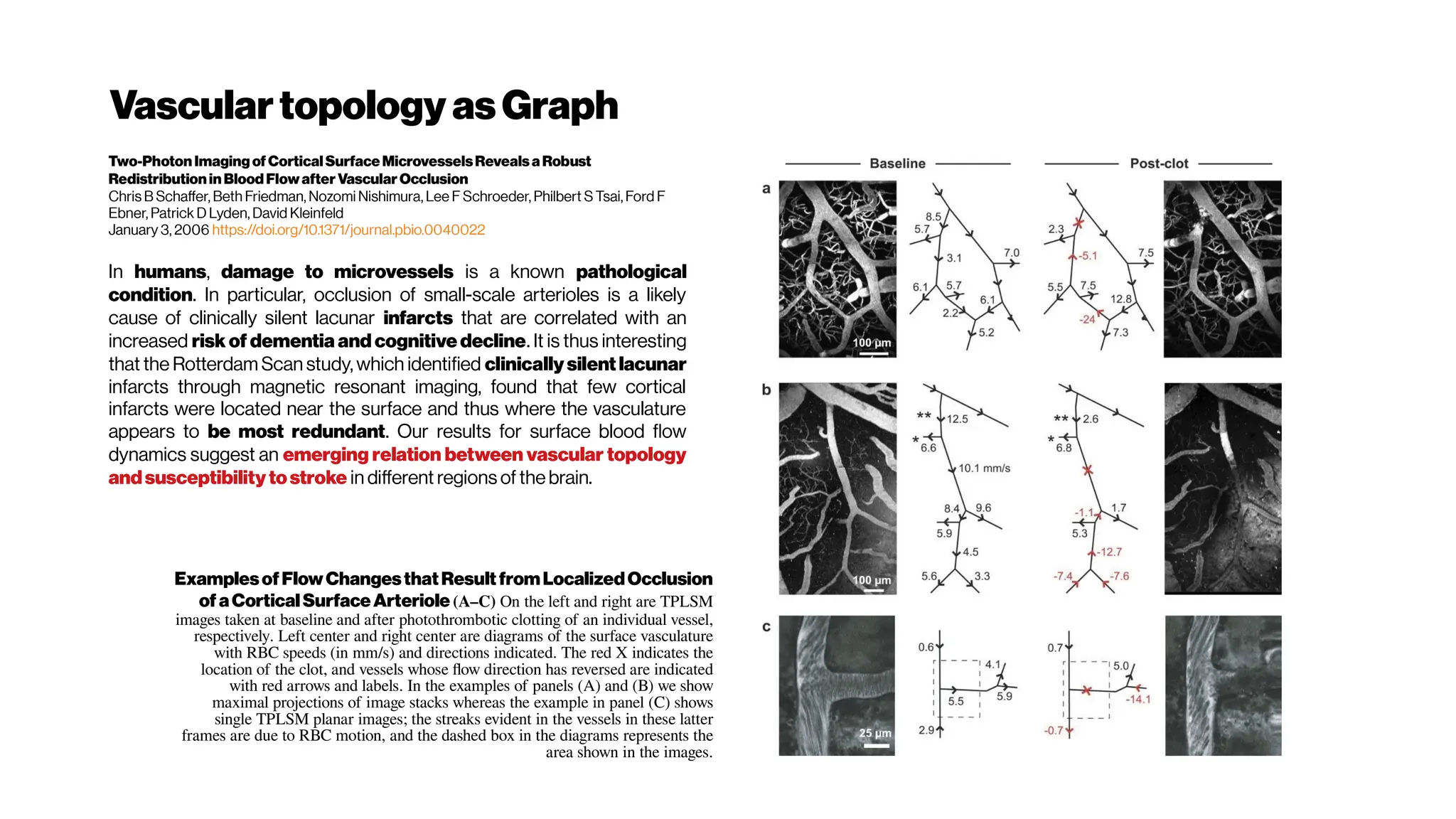 Vasculartopology asGraph
Two-Photon Imaging of CorticalSurface MicrovesselsRevealsa Robust
Redistribution in Blood Flow after Vascular Occlusion
Chris B Schaffer, Beth Friedman, Nozomi Nishimura, Lee F Schroeder, Philbert S Tsai, Ford F
Ebner, Patrick D Lyden, David Kleinfeld
January 3, 2006 https://doi.org/10.1371/journal.pbio.0040022
In humans, damage to microvessels is a known pathological
condition. In particular, occlusion of small-scale arterioles is a likely
cause of clinically silent lacunar infarcts that are correlated with an
increased risk of dementia and cognitive decline. It is thus interesting
that the Rotterdam Scan study, which identified clinically silentlacunar
infarcts through magnetic resonant imaging, found that few cortical
infarcts were located near the surface and thus where the vasculature
appears to be most redundant. Our results for surface blood flow
dynamics suggest an emerging relation between vascular topology
andsusceptibility tostroke in different regions of the brain.
ExamplesofFlowChangesthatResultfromLocalizedOcclusion
ofaCorticalSurfaceArteriole (A–C) On the left and right are TPLSM
images taken at baseline and after photothrombotic clotting of an individual vessel,
respectively. Left center and right center are diagrams of the surface vasculature
with RBC speeds (in mm/s) and directions indicated. The red X indicates the
location of the clot, and vessels whose flow direction has reversed are indicated
with red arrows and labels. In the examples of panels (A) and (B) we show
maximal projections of image stacks whereas the example in panel (C) shows
single TPLSM planar images; the streaks evident in the vessels in these latter
frames are due to RBC motion, and the dashed box in the diagrams represents the
area shown in the images.
 