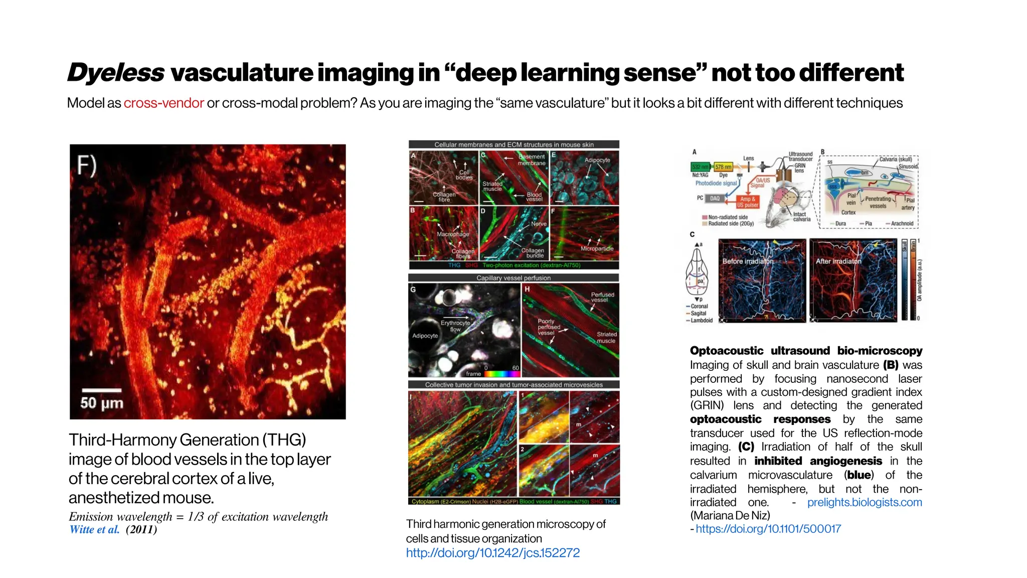 Dyeless vasculatureimaging in “deeplearningsense” nottoo different
Third-Harmony Generation (THG)
image of blood vessels in the top layer
of the cerebralcortex of a live,
anesthetized mouse.
Emission wavelength = 1/3 of excitation wavelength
Witte et al. (2011)
Optoacoustic ultrasound bio-microscopy
Imaging of skull and brain vasculature (B) was
performed by focusing nanosecond laser
pulses with a custom-designed gradient index
(GRIN) lens and detecting the generated
optoacoustic responses by the same
transducer used for the US reflection-mode
imaging. (C) Irradiation of half of the skull
resulted in inhibited angiogenesis in the
calvarium microvasculature (blue) of the
irradiated hemisphere, but not the non-
irradiated one. - prelights.biologists.com
(Mariana De Niz)
- https://doi.org/10.1101/500017
Third harmonic generation microscopy of
cells andtissue organization
http://doi.org/10.1242/jcs.152272
Model as cross-vendor or cross-modal problem? As you are imaging the “same vasculature” but it looks a bit different with different techniques
 