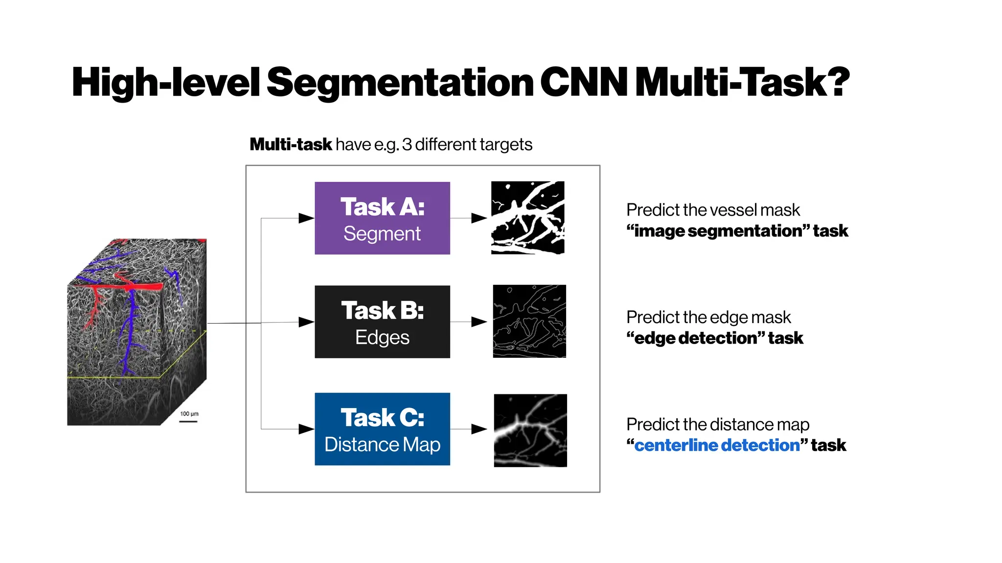 High-level SegmentationCNNMulti-Task?
Multi-task have e.g. 3 different targets
Predict the vessel mask
“imagesegmentation”task
Predict the edge mask
“edgedetection”task
Predict the distance map
“centerlinedetection”task
TaskA:
Segment
TaskB:
Edges
Task C:
Distance Map
 