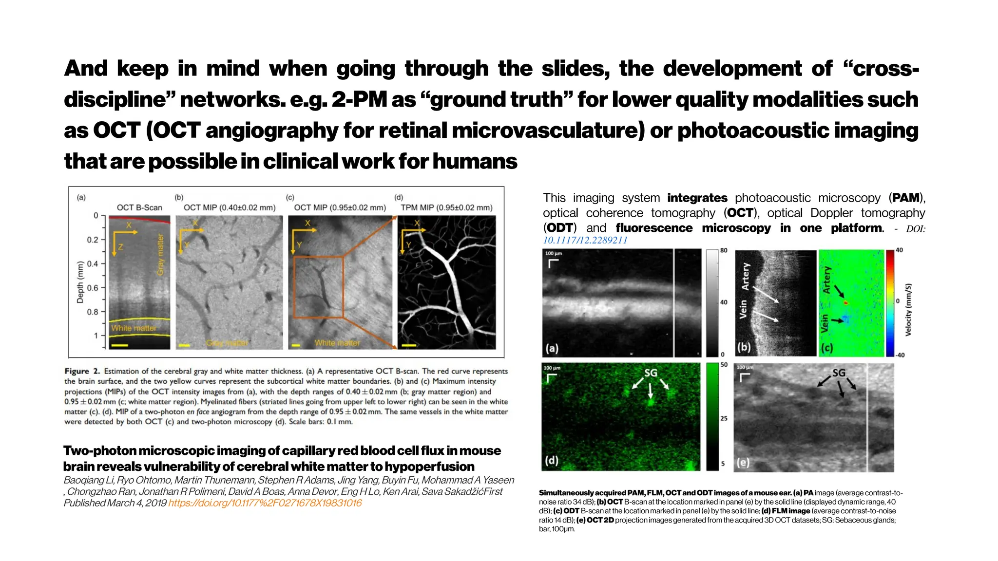 And keep in mind when going through the slides, the development of “cross-
discipline” networks. e.g. 2-PM as “ground truth” for lower quality modalities such
as OCT (OCT angiography for retinal microvasculature) or photoacoustic imaging
thatarepossibleinclinicalworkforhumans
Two-photonmicroscopic imagingofcapillaryred bloodcellfluxinmouse
brainreveals vulnerabilityofcerebralwhitemattertohypoperfusion
Baoqiang Li, Ryo Ohtomo, Martin Thunemann,Stephen R Adams, Jing Yang,Buyin Fu, Mohammad AYaseen
, Chongzhao Ran, Jonathan R Polimeni, David A Boas, Anna Devor,Eng H Lo, Ken Arai,Sava SakadžićFirst
Published March 4,2019 https://doi.org/10.1177%2F0271678X19831016
This imaging system integrates photoacoustic microscopy (PAM),
optical coherence tomography (OCT), optical Doppler tomography
(ODT) and fluorescence microscopy in one platform. - DOI:
10.1117/12.2289211
SimultaneouslyacquiredPAM,FLM,OCTandODTimagesofamouse ear.(a)PA image (average contrast-to-
noise ratio 34dB);(b)OCTB-scan at the location marked in panel (e) by the solid line (displayed dynamic range,40
dB); (c)ODT B-scanatthe locationmarked in panel (e)bythe solid line; (d)FLMimage (average contrast-to-noise
ratio 14dB);(e)OCT2Dprojection images generated from the acquired 3D OCT datasets; SG: Sebaceous glands;
bar, 100μm.
 