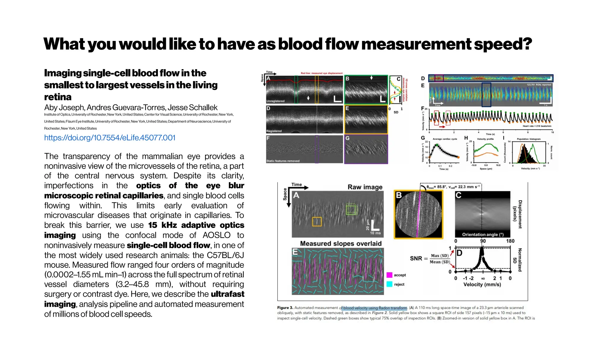 Whatyouwouldliketohaveasbloodflowmeasurementspeed?
Imagingsingle-cellblood flow inthe
smallesttolargest vesselsintheliving
retina
Aby Joseph, Andres Guevara-Torres, Jesse Schallek
Institute of Optics,University of Rochester,New York, United States;CenterforVisual Science, University ofRochester, New York,
United States; Flaum Eye Institute, University ofRochester, New York,United States; Department ofNeuroscience, University of
Rochester,New York, United States
https://doi.org/10.7554/eLife.45077.001
The transparency of the mammalian eye provides a
noninvasive view of the microvessels of the retina, a part
of the central nervous system. Despite its clarity,
imperfections in the optics of the eye blur
microscopic retinal capillaries, and single blood cells
flowing within. This limits early evaluation of
microvascular diseases that originate in capillaries. To
break this barrier, we use 15 kHz adaptive optics
imaging using the confocal mode of AOSLO to
noninvasively measure single-cell blood flow, in one of
the most widely used research animals: the C57BL/6J
mouse. Measured flow ranged four orders of magnitude
(0.0002–1.55 mL min–1) across the full spectrum of retinal
vessel diameters (3.2–45.8 mm), without requiring
surgery or contrast dye. Here, we describe the ultrafast
imaging, analysis pipeline and automated measurement
of millions of blood cell speeds.
 