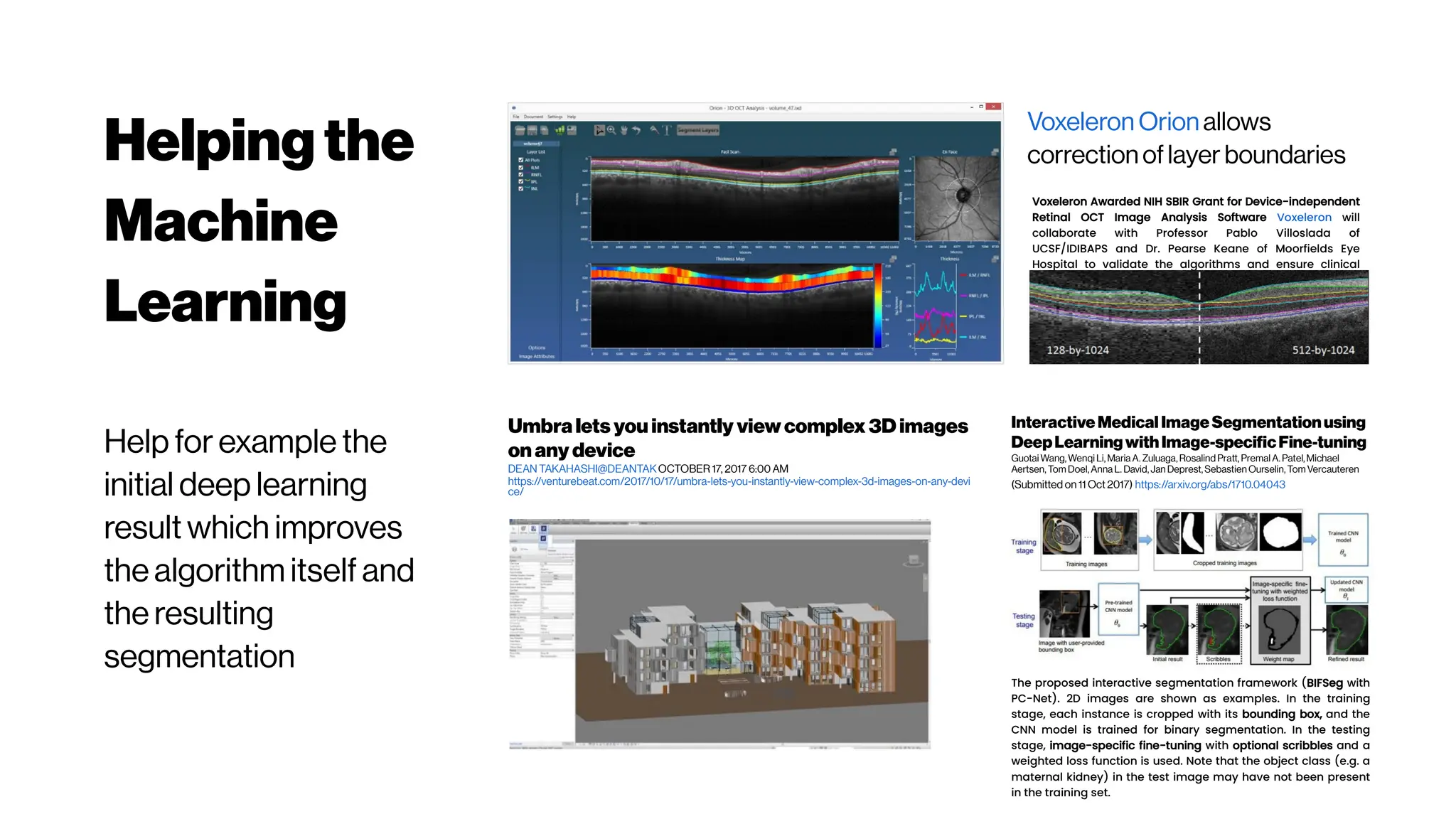 Helpingthe
Machine
Learning
Help for example the
initial deep learning
result which improves
the algorithm itself and
the resulting
segmentation
Umbralets you instantly view complex 3D images
on any device
DEAN TAKAHASHI@DEANTAKOCTOBER 17, 2017 6:00 AM
https://venturebeat.com/2017/10/17/umbra-lets-you-instantly-view-complex-3d-images-on-any-devi
ce/
Voxeleron Awarded NIH SBIR Grant for Device-independent
Retinal OCT Image Analysis Software Voxeleron will
collaborate with Professor Pablo Villoslada of
UCSF/IDIBAPS and Dr. Pearse Keane of Moorfields Eye
Hospital to validate the algorithms and ensure clinical
utility. February 8, 2017
VoxeleronOrionallows
correctionoflayer boundaries
InteractiveMedical ImageSegmentationusing
DeepLearningwithImage-specificFine-tuning
Guotai Wang,Wenqi Li,Maria A. Zuluaga,Rosalind Pratt,Premal A.Patel,Michael
Aertsen,Tom Doel,Anna L. David,Jan Deprest,Sebastien Ourselin,TomVercauteren
(Submitted on 11 Oct 2017) https://arxiv.org/abs/1710.04043
The proposed interactive segmentation framework (BIFSeg with
PC-Net). 2D images are shown as examples. In the training
stage, each instance is cropped with its bounding box, and the
CNN model is trained for binary segmentation. In the testing
stage, image-specific fine-tuning with optional scribbles and a
weighted loss function is used. Note that the object class (e.g. a
maternal kidney) in the test image may have not been present
in the training set.
 