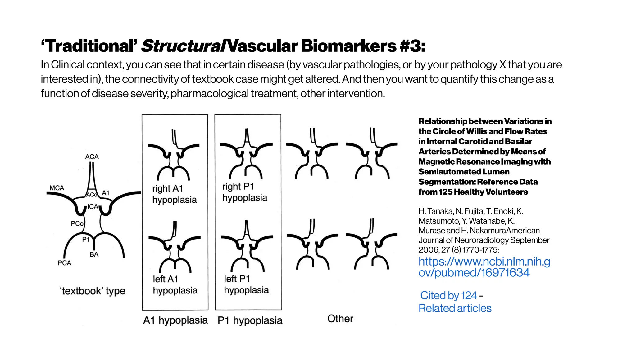 ‘Traditional’StructuralVascularBiomarkers #3:
InClinical context,you cansee that incertaindisease (by vascularpathologies, or by yourpathology Xthatyou are
interestedin), the connectivity oftextbook case mightget altered.Andthenyouwantto quantify thischange asa
function ofdisease severity,pharmacological treatment,otherintervention.
RelationshipbetweenVariations in
theCircleofWillis andFlowRates
inInternalCarotidandBasilar
Arteries DeterminedbyMeans of
MagneticResonanceImagingwith
SemiautomatedLumen
Segmentation:ReferenceData
from125 Healthy Volunteers
H. Tanaka, N. Fujita, T. Enoki, K.
Matsumoto, Y. Watanabe, K.
Murase and H. NakamuraAmerican
Journal of Neuroradiology September
2006, 27 (8) 1770-1775;
https://www.ncbi.nlm.nih.g
ov/pubmed/16971634
Cited by 124 -
Related articles
 