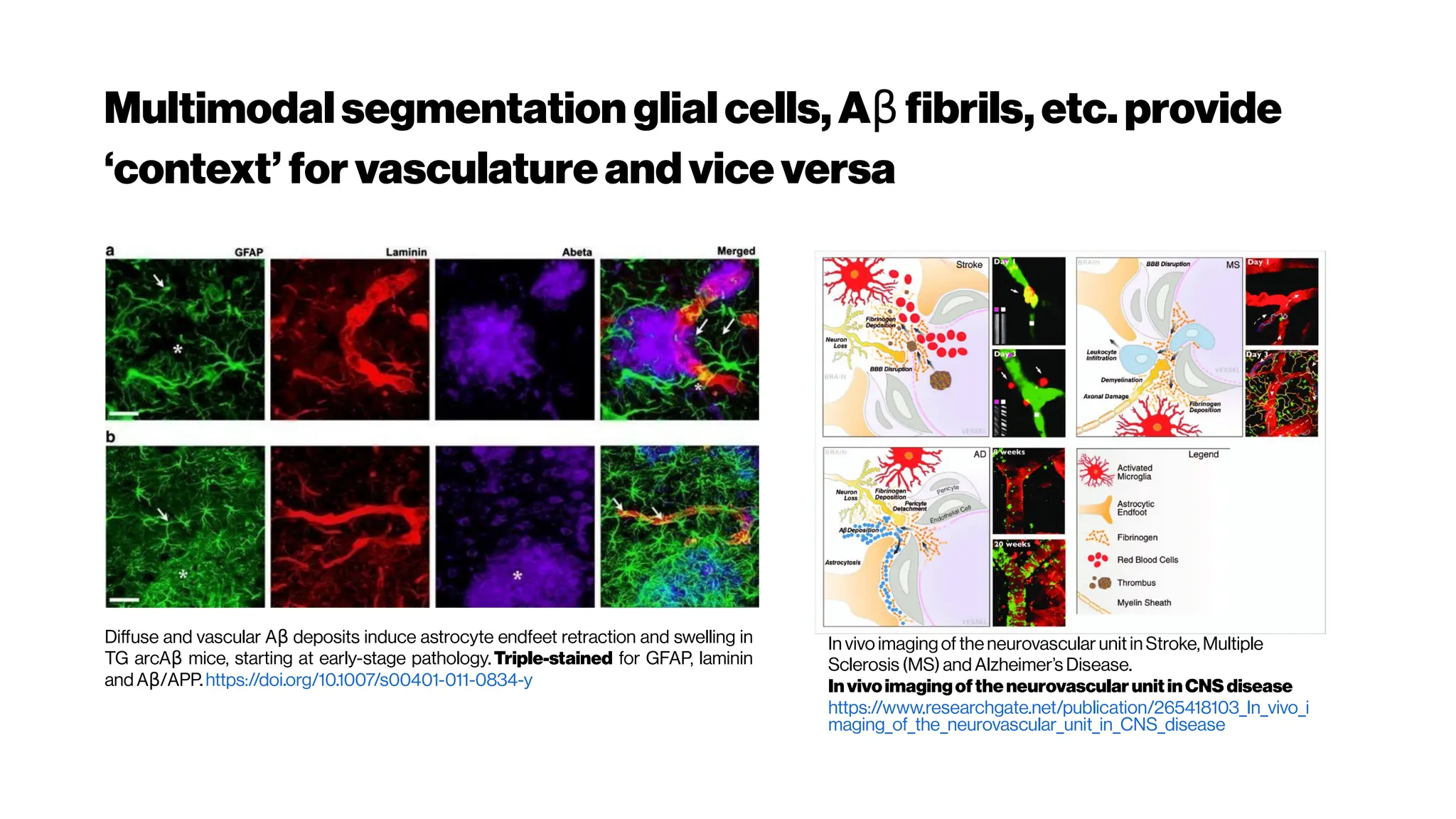 Multimodalsegmentation glialcells,A fibrils,etc.provide
β
‘context’ for vasculatureandviceversa
Diffuse and vascular A deposits induce astrocyte endfeet retraction and swelling in
β
TG arcA mice, starting at early-stage pathology.
β Triple-stained for GFAP, laminin
and A /APP.
β https://doi.org/10.1007/s00401-011-0834-y
In vivo imagingof theneurovascular unit in Stroke,Multiple
Sclerosis (MS) and Alzheimer’s Disease.
InvivoimagingoftheneurovascularunitinCNS disease
https://www.researchgate.net/publication/265418103_In_vivo_i
maging_of_the_neurovascular_unit_in_CNS_disease
 