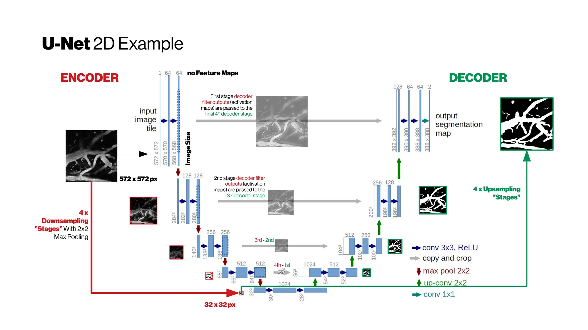 U-Net 2D Example
Image
Size
noFeatureMaps
4x
Downsampling
”Stages”With 2x2
Max Pooling
572 x572 px
32 x32px
4xUpsampling
”Stages”
ENCODER DECODER
First stage decoder
filter outputs (activation
maps) are passedtothe
final4th
decoder stage
2ndstage decoder filter
outputs (activation
maps) are passedtothe
3rd
decoder stage
3rd - 2nd
4th- 1st
 