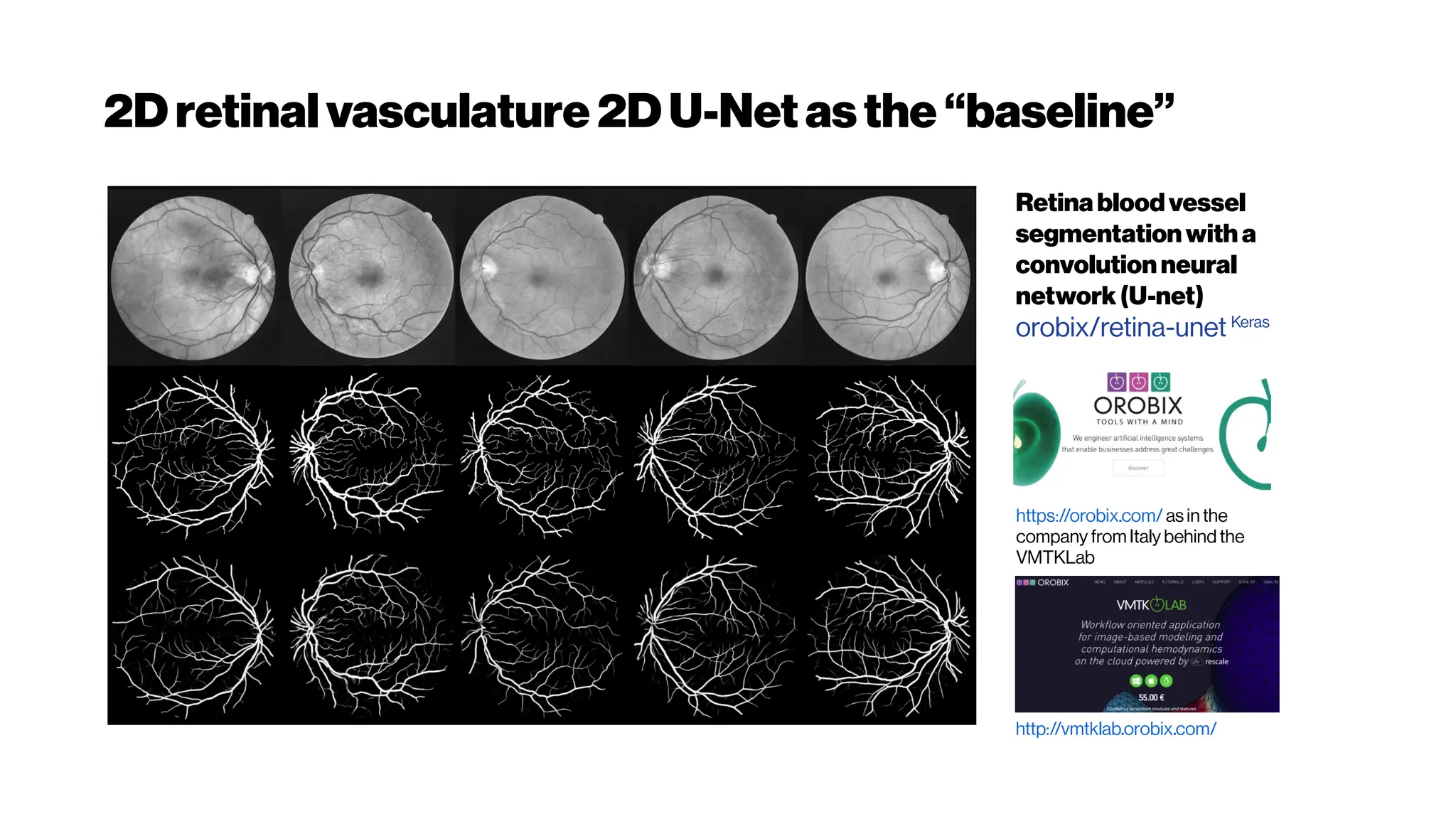 2Dretinalvasculature 2DU-Netasthe “baseline”
Retinabloodvessel
segmentationwith a
convolutionneural
network(U-net)
orobix/retina-unet Keras
http://vmtklab.orobix.com/
https://orobix.com/ as in the
company from Italy behind the
VMTKLab
 