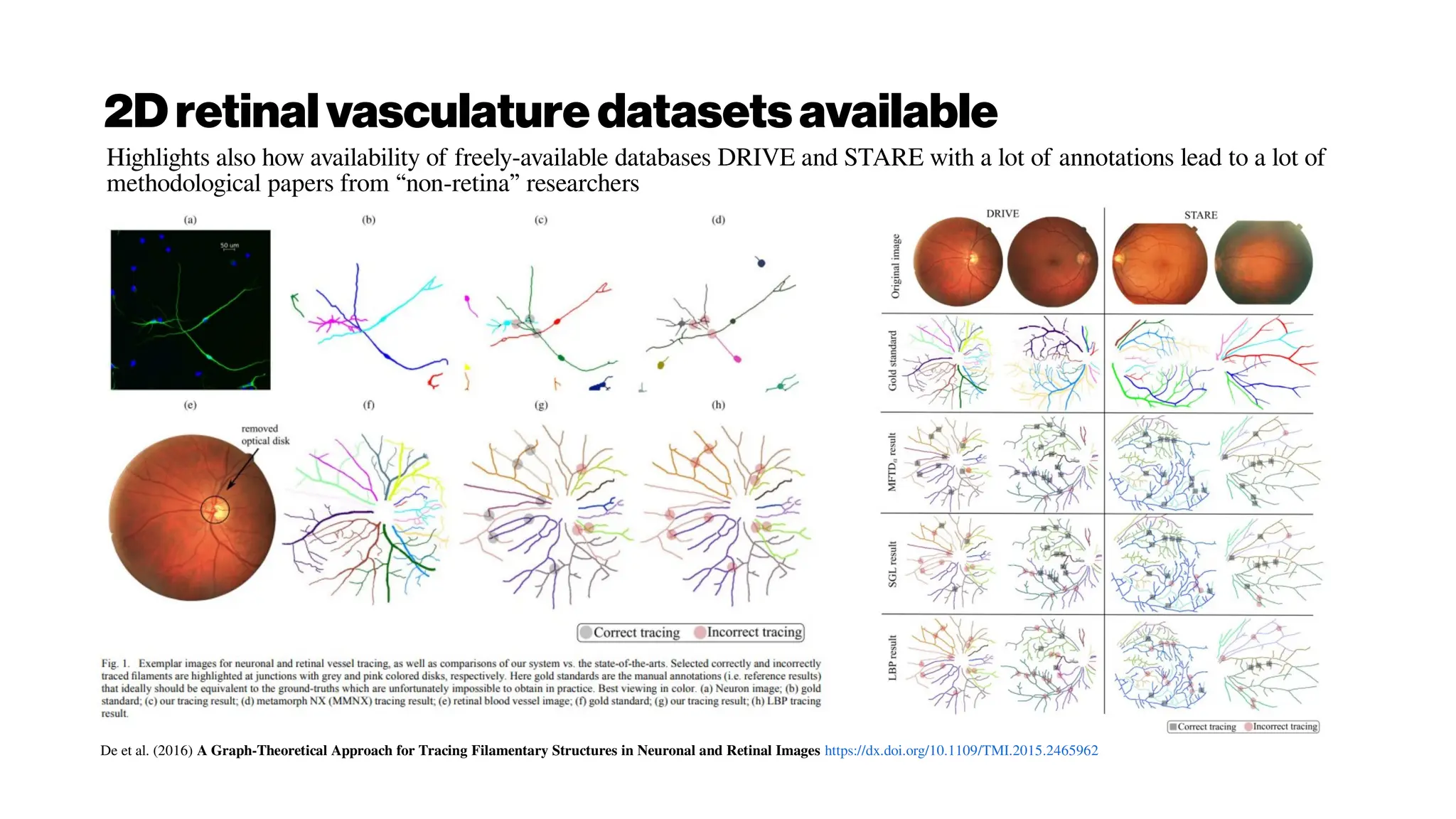 2Dretinalvasculature datasetsavailable
Highlights also how availability of freely-available databases DRIVE and STARE with a lot of annotations lead to a lot of
methodological papers from “non-retina” researchers
De et al. (2016) A Graph-Theoretical Approach for Tracing Filamentary Structures in Neuronal and Retinal Images https://dx.doi.org/10.1109/TMI.2015.2465962
 