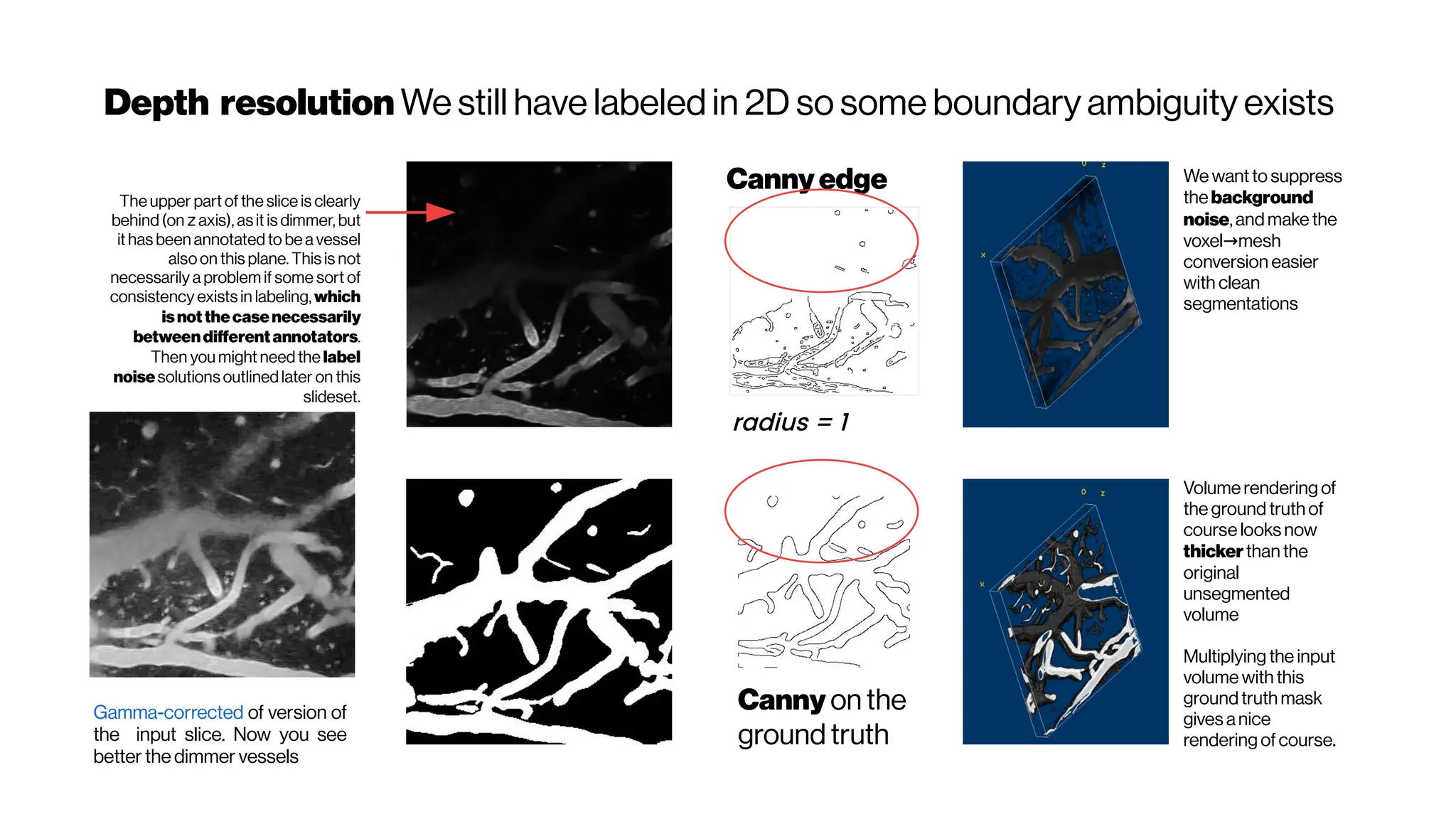 Depth resolution We still have labeled in 2D so some boundary ambiguity exists
Cannyedge
radius = 1
Canny on the
ground truth
Gamma-corrected of version of
the input slice. Now you see
better the dimmer vessels
The upper part of the slice is clearly
behind(on z axis), as it is dimmer, but
it has been annotated to be a vessel
alsoon this plane. This is not
necessarily a problem if some sort of
consistency exists in labeling, which
isnot thecasenecessarily
betweendifferent annotators.
Then you might need the label
noisesolutions outlinedlater on this
slideset.
Volumerendering of
the ground truth of
courselooks now
thickerthan the
original
unsegmented
volume
Multiplying the input
volume with this
groundtruth mask
gives anice
rendering ofcourse.
We wantto suppress
thebackground
noise,andmake the
voxel mesh
→
conversion easier
with clean
segmentations
 