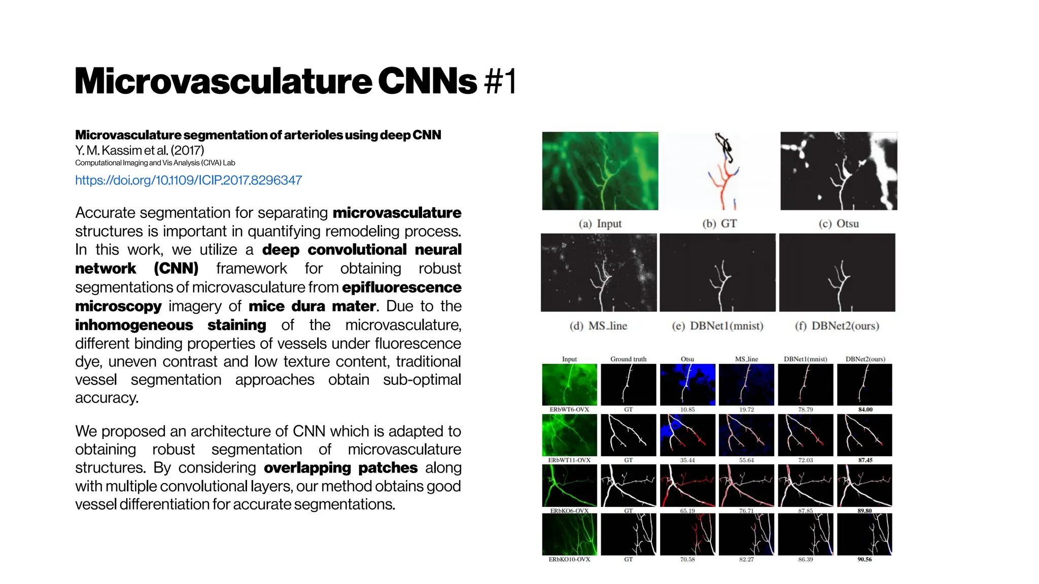 MicrovasculatureCNNs #1
MicrovasculaturesegmentationofarteriolesusingdeepCNN
Y. M.Kassimet al. (2017)
ComputationalImaging and Vis Analysis (CIVA) Lab
https://doi.org/10.1109/ICIP.2017.8296347
Accurate segmentation for separating microvasculature
structures is important in quantifying remodeling process.
In this work, we utilize a deep convolutional neural
network (CNN) framework for obtaining robust
segmentations of microvasculature from epifluorescence
microscopy imagery of mice dura mater. Due to the
inhomogeneous staining of the microvasculature,
different binding properties of vessels under fluorescence
dye, uneven contrast and low texture content, traditional
vessel segmentation approaches obtain sub-optimal
accuracy.
We proposed an architecture of CNN which is adapted to
obtaining robust segmentation of microvasculature
structures. By considering overlapping patches along
with multiple convolutional layers, our method obtains good
vessel differentiation for accurate segmentations.
 