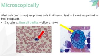 Myeloma is a malignant disease of the plasma cells of bone marrow ...