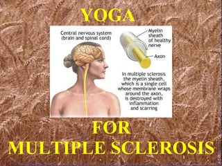 FOR MULTIPLE SCLEROSIS YOGA 