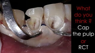 Multiple class v case presentation | PDF