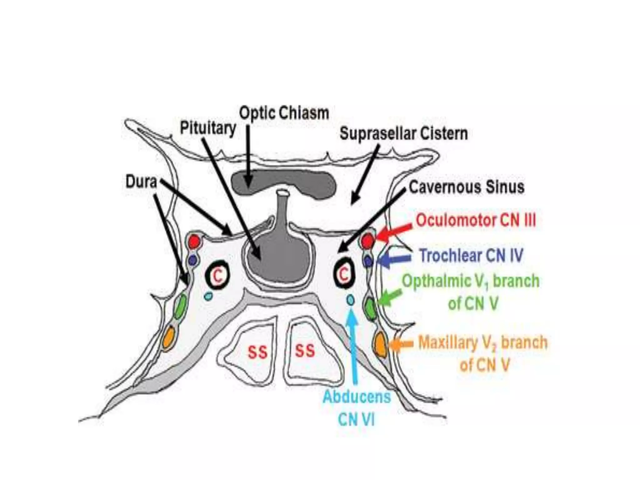 Multiple cranial nerve palsies | PPTX