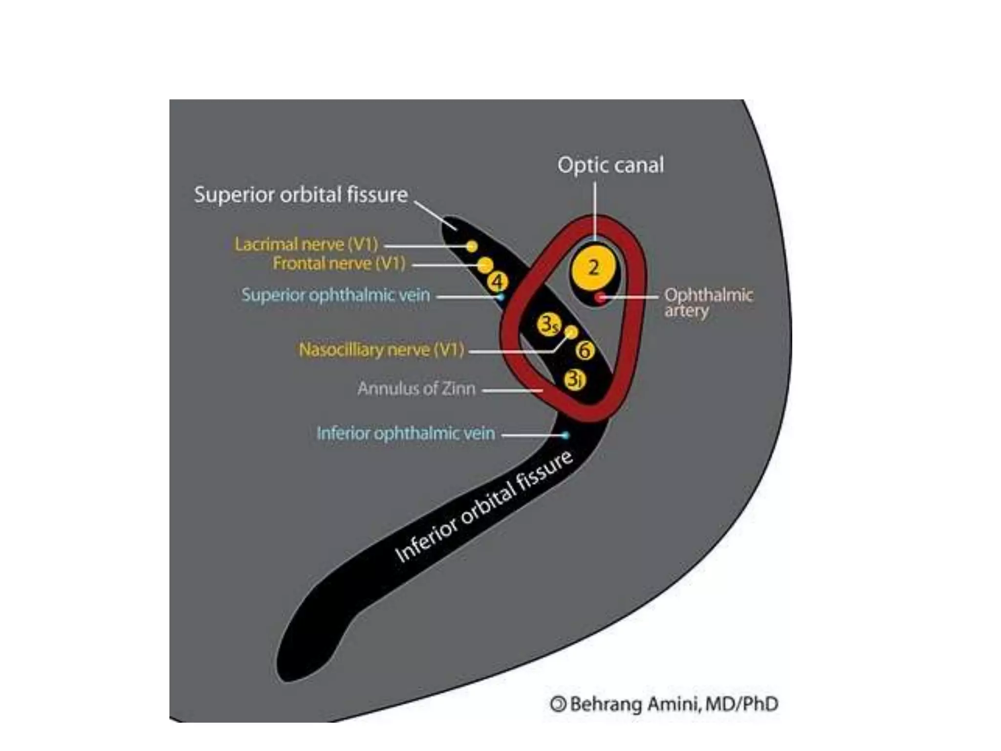 Multiple cranial nerve palsies | PPTX