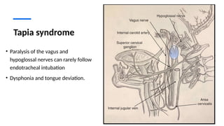Multiple Cranial Nerve Pabbbbblsy Med.pptx