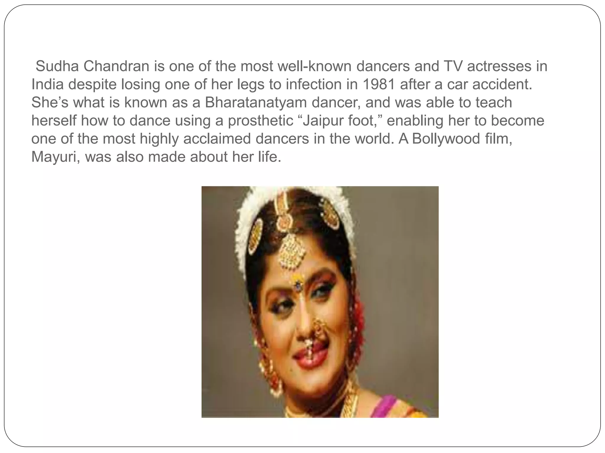 Sudha Chandran is one of the most well-known dancers and TV actresses in
India despite losing one of her legs to infection in 1981 after a car accident.
She’s what is known as a Bharatanatyam dancer, and was able to teach
herself how to dance using a prosthetic “Jaipur foot,” enabling her to become
one of the most highly acclaimed dancers in the world. A Bollywood film,
Mayuri, was also made about her life.
 