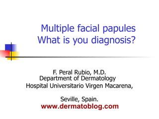 Multiple facial papules What is you diagnosis? F. Peral Rubio, M.D. Department of Dermatology  Hospital Universitario Virgen Macarena,  Seville, Spain. www.dermatoblog.com 