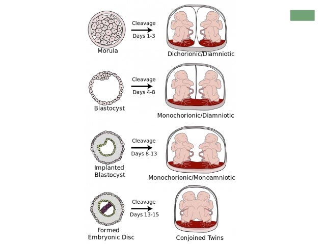 photo of 16 week fetus