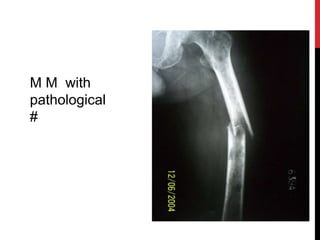 M M with
pathological
#
 