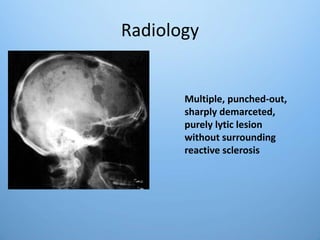 Radiology
Multiple, punched-out,
sharply demarceted,
purely lytic lesion
without surrounding
reactive sclerosis
 