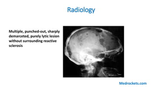Radiology
Multiple, punched-out, sharply
demarceted, purely lytic lesion
without surrounding reactive
sclerosis
Medrockets.com
 