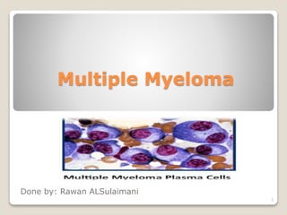 Multiple Myeloma
Done by: Rawan ALSulaimani
1
 