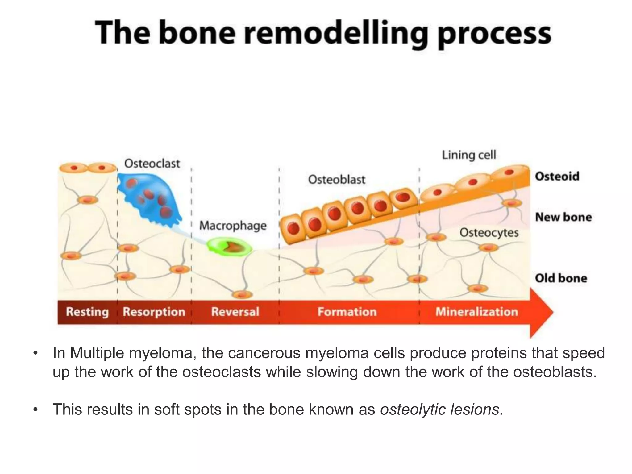 • In Multiple myeloma, the cancerous myeloma cells produce proteins that speed
up the work of the osteoclasts while slowing down the work of the osteoblasts.
• This results in soft spots in the bone known as osteolytic lesions.
 